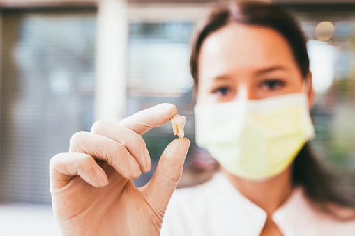 Dentist holding up an extracted tooth