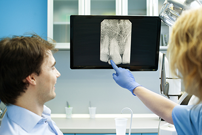 Why Do You Need Dental X ray?